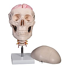 Череп с 8 части на мозъка, Анатомия на човека